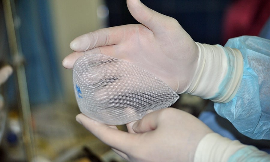 Способ герниопластики сетчатым имплантатом вентральных грыж